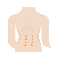 Reduce Lower Back Pain